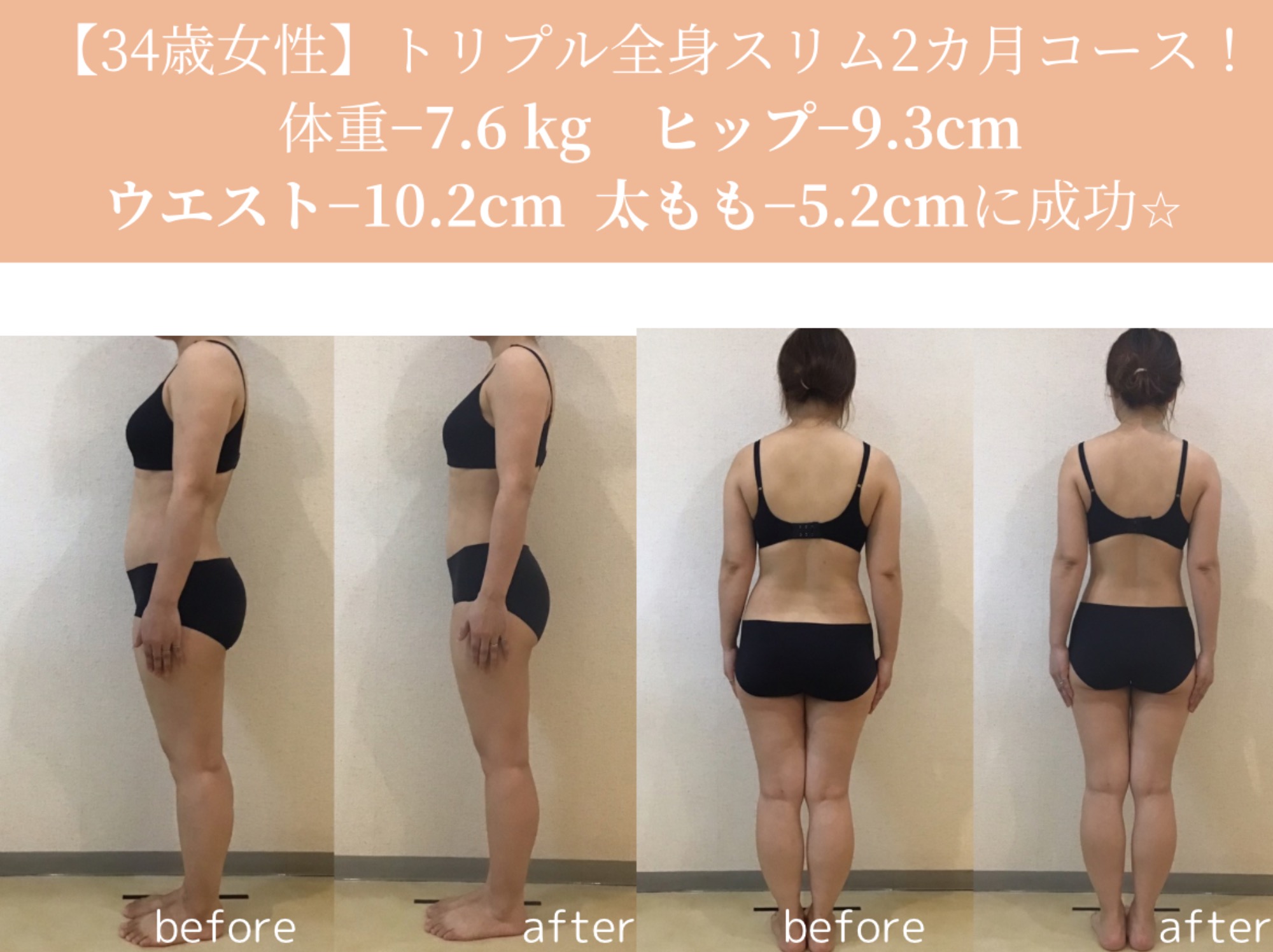 トリプル全身スリム最新ビフォーアフター｜岡崎市の痩身エステ施術例