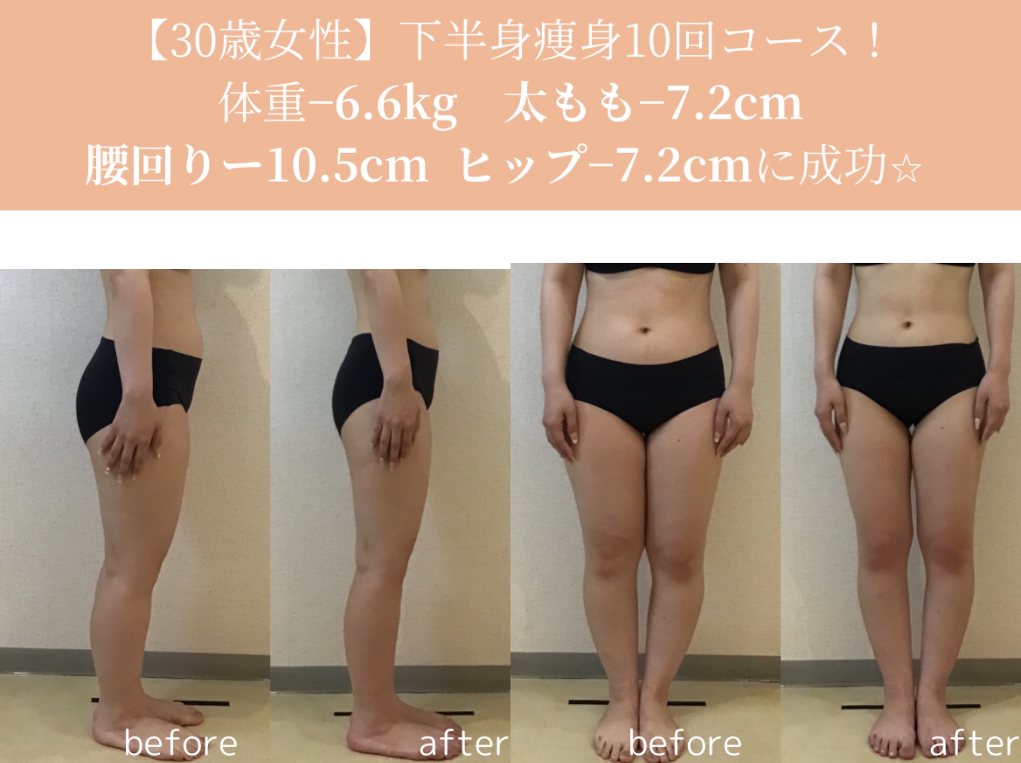 冷えむくみ足解消！下半身集中10コースビフォーアフター｜岡崎市の痩身エステ施術例
