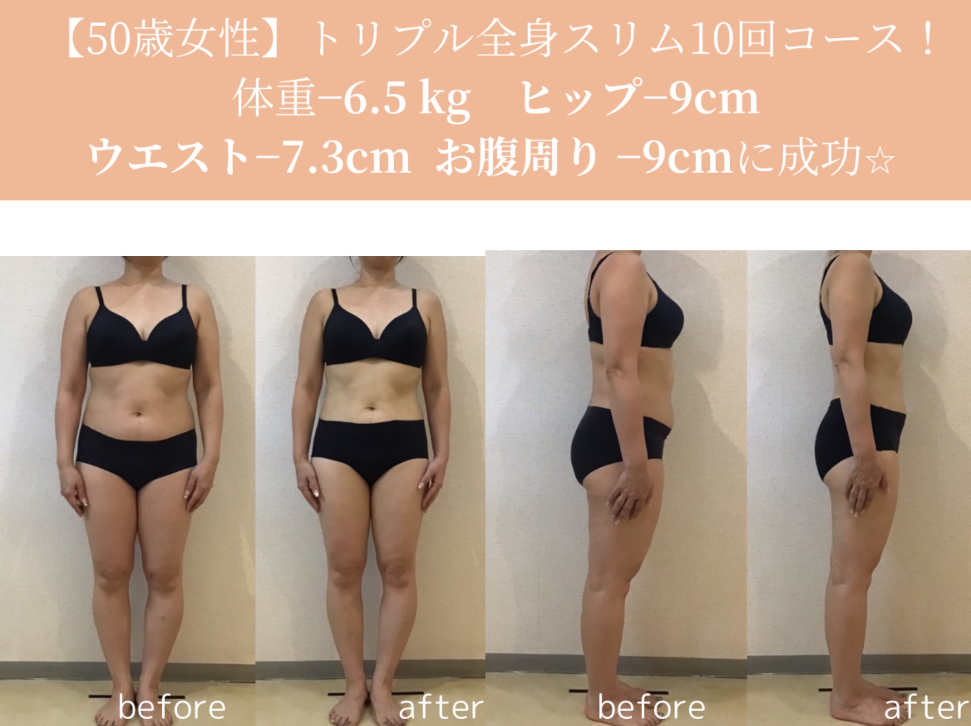短期間痩身ダイエットスリムビフォーアフター☆｜岡崎市の痩身エステ施術例