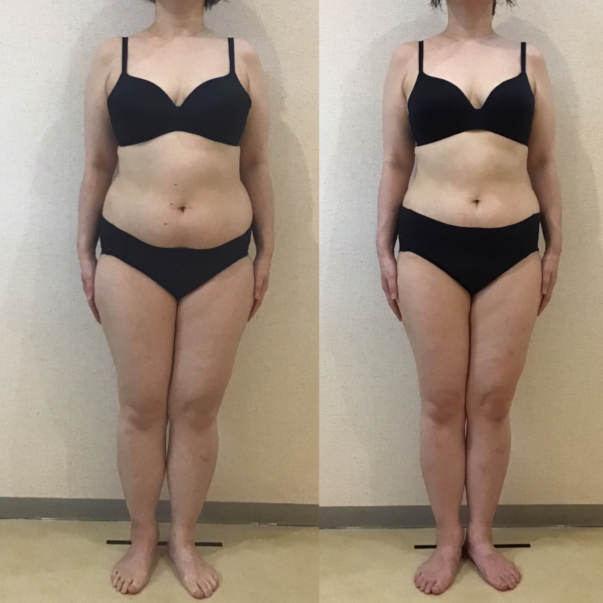 41歳トリプル全身スリム20回ー９、1kg達成！ビフォーアフター｜岡崎市の痩身エステ施術例