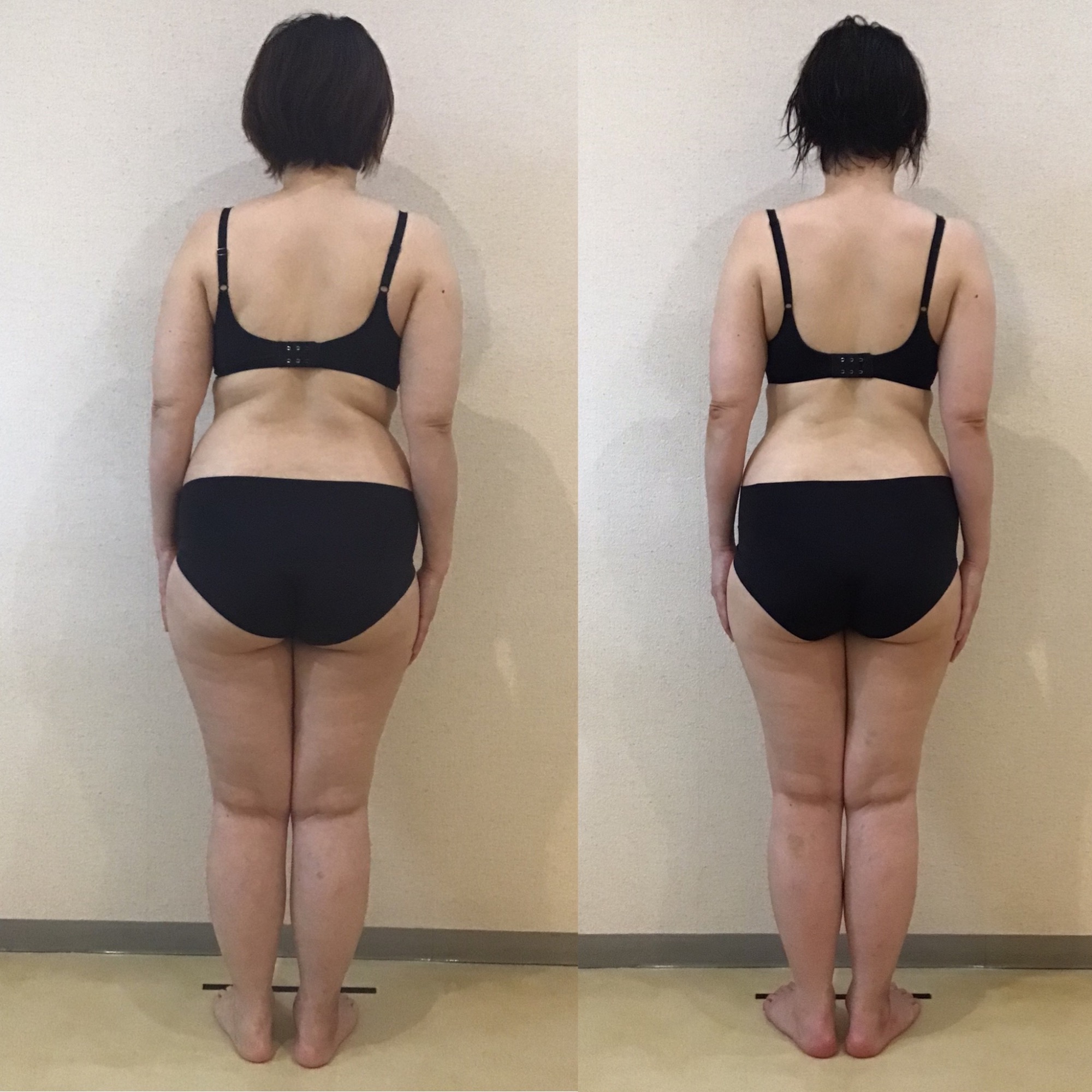 痩身ダイエットー９、1kg達成！！ビフォーアフター★｜岡崎市の痩身エステ施術例