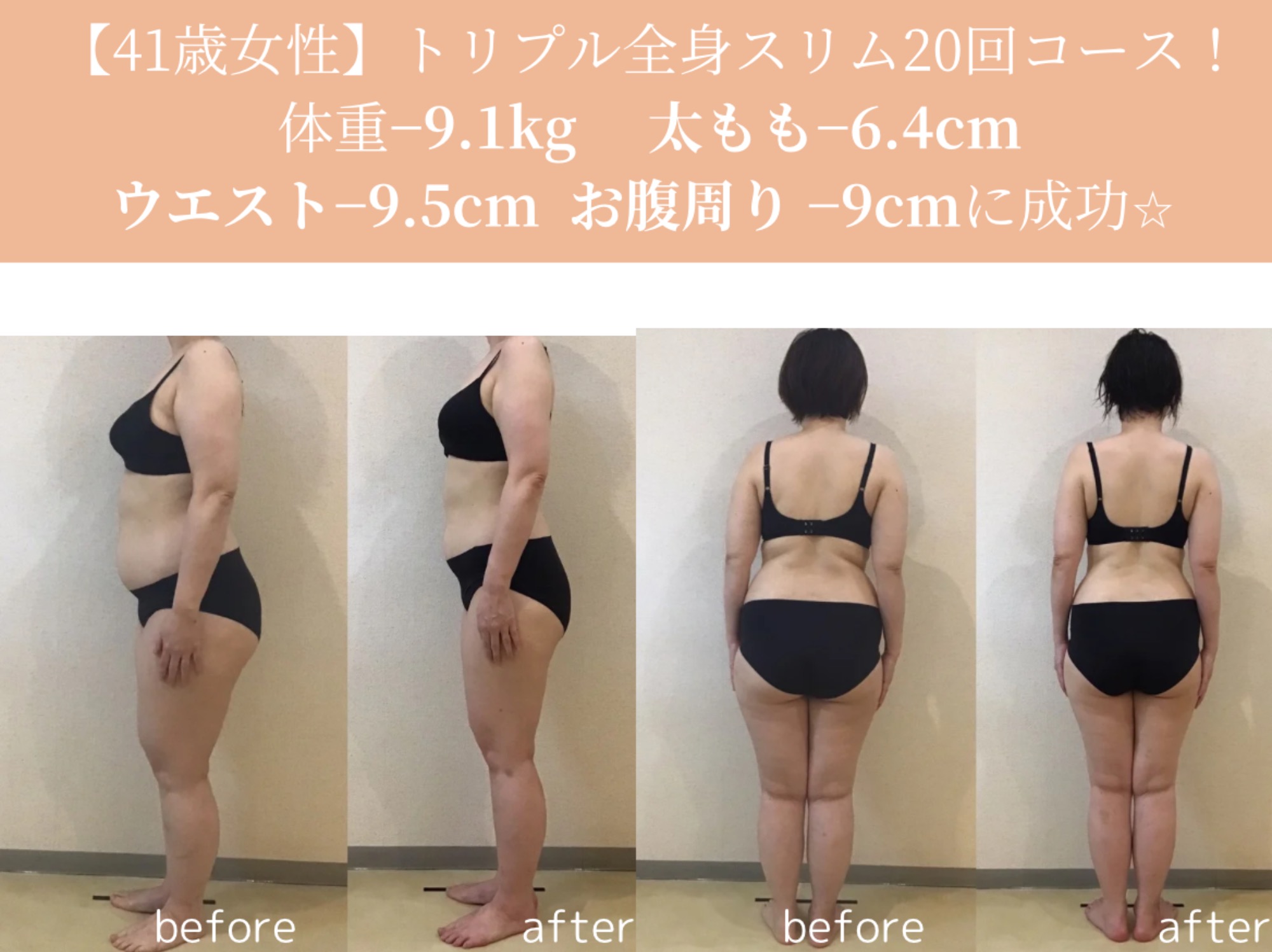 大人女子痩身ダイエットスリム！　41歳　−9、1kg達成★｜岡崎市の痩身エステ施術例