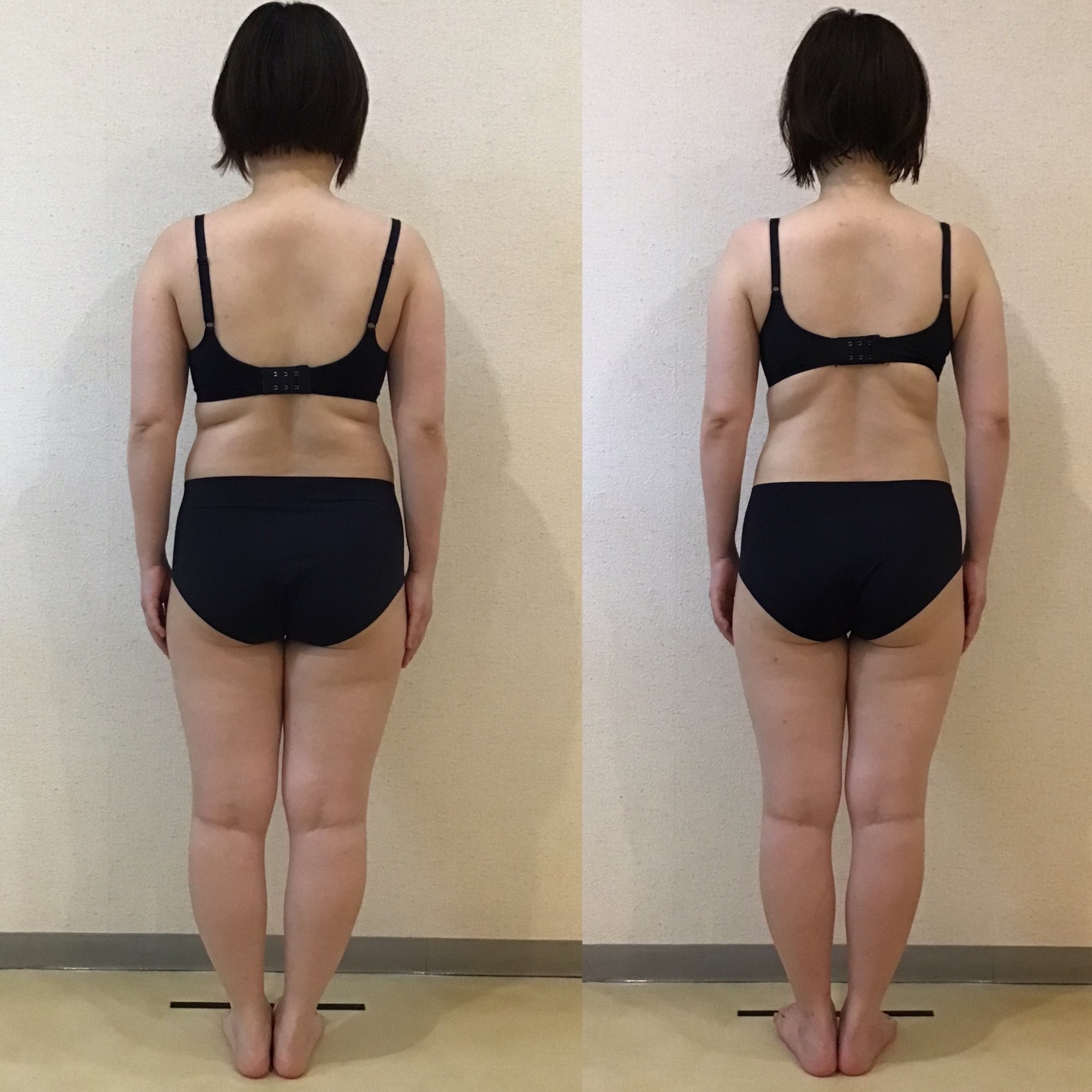 26歳トリプル全身スリムビフォーアフター★｜岡崎市の痩身エステ施術例