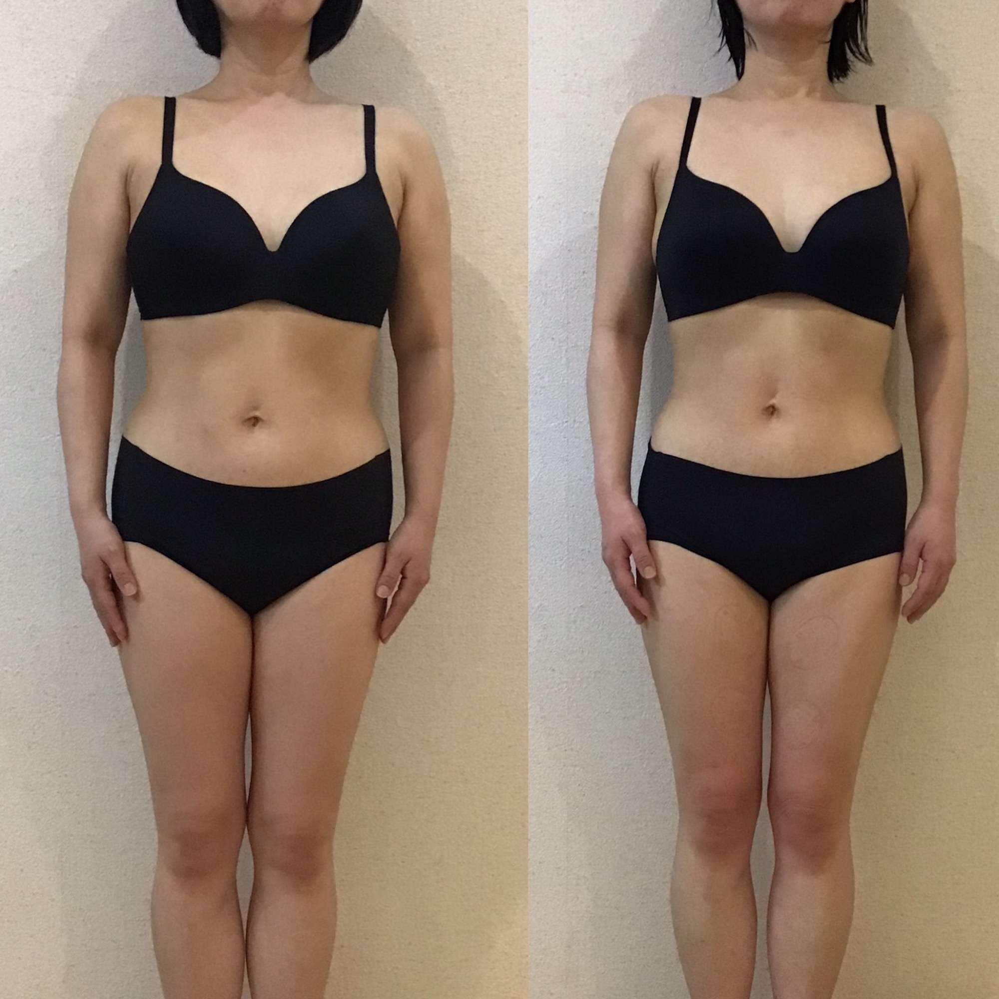 46歳トリプル全身スリムコース最新ビフォーアフター☆｜岡崎市の痩身エステ施術例
