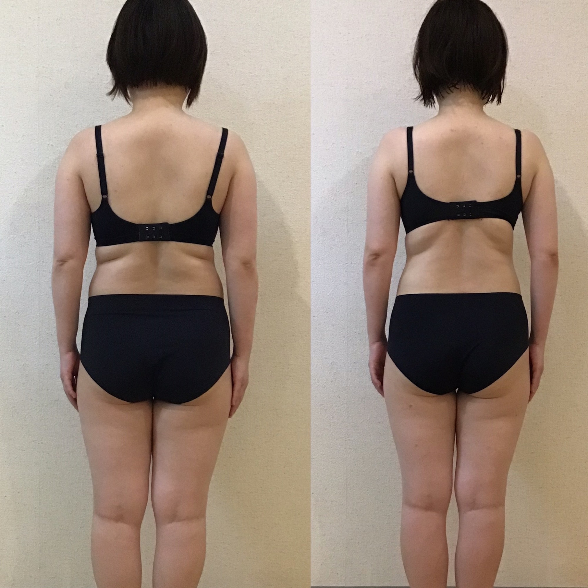 26歳　ー４、9kg達成！！　トリプル全身スリムビフォーアフター